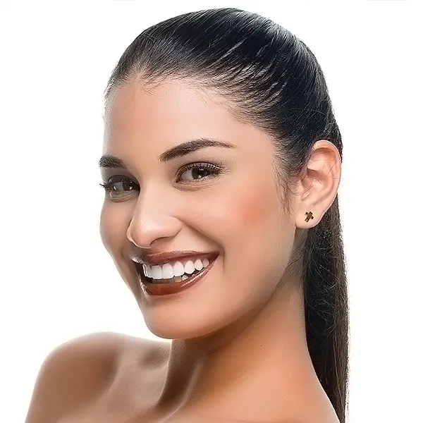 Img-servicios-Blanqueamiento dental