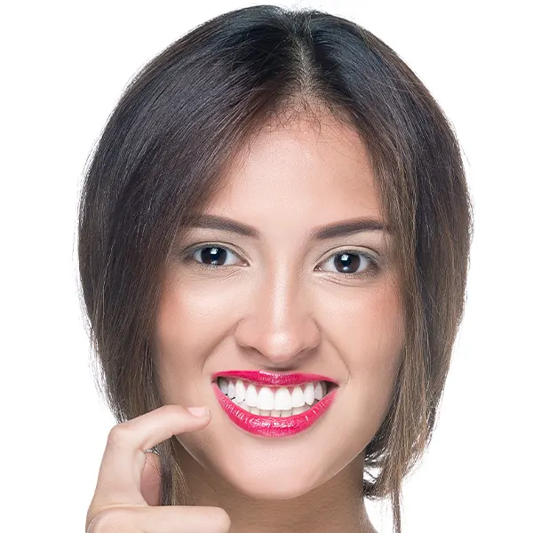 Img-servicios-Diseño de sonrisa