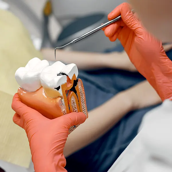 Img-servicios-Endodoncia