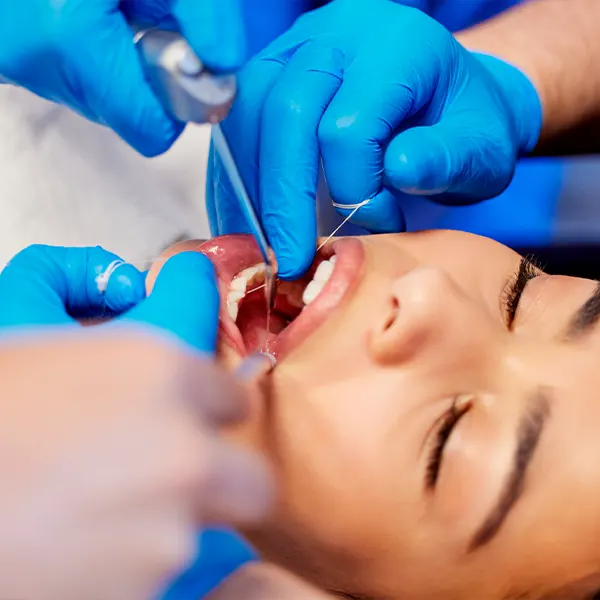 Img-servicios-Limpieza dental