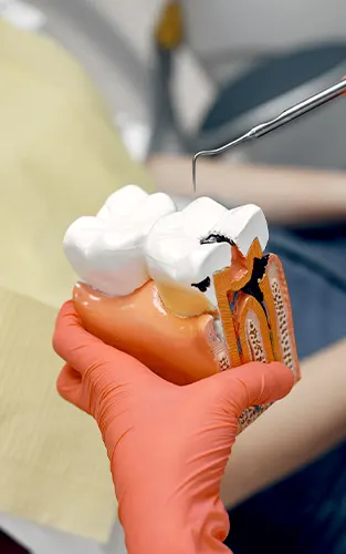 img-endodoncia-en-bucaramanga-1-LCP