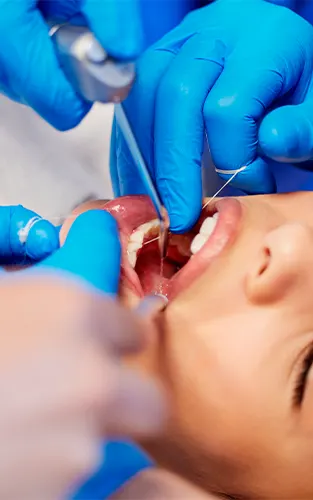 img-limpieza-dental-en-bucaramanga-1-LCP