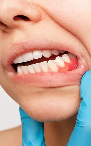 img-periodoncista-en-bucaramanga-1-LCP