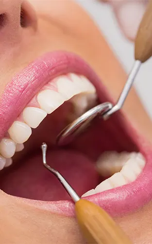 img-rehabilitacion-oral-en-bucaramanga-1-LCP